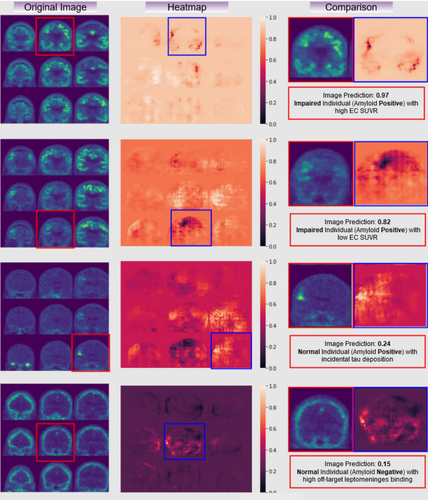 Examples of raw tau PET images